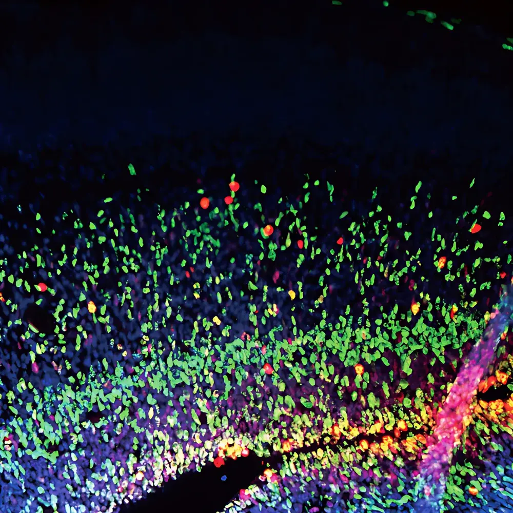 SOPTOP CLSM610 Laser Scanning Confocal Microscope