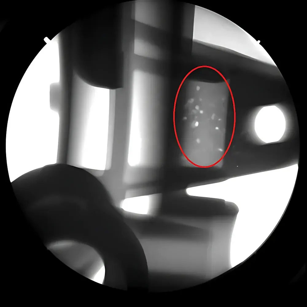 Aolong X-ray Digital Real-time Imaging System