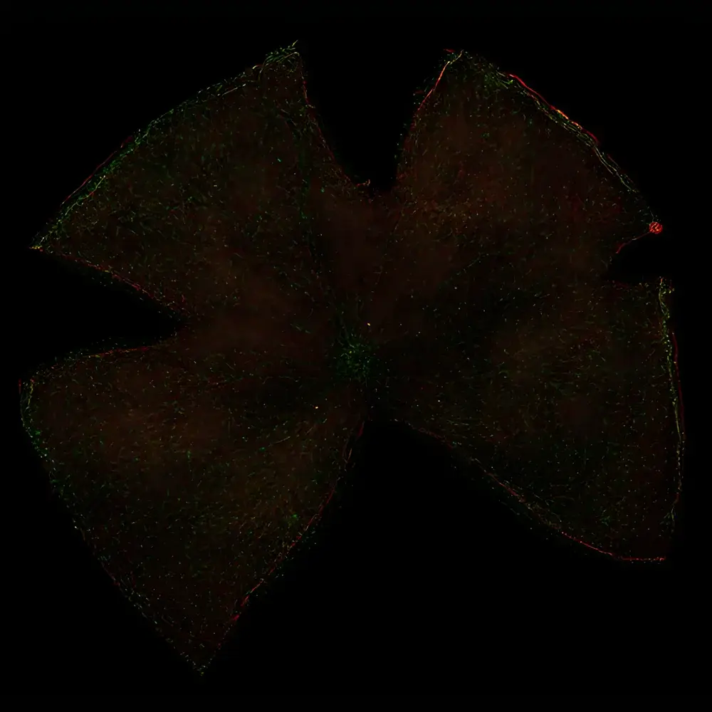Leica THUNDER Imager 3D Live Cell Microscopy System