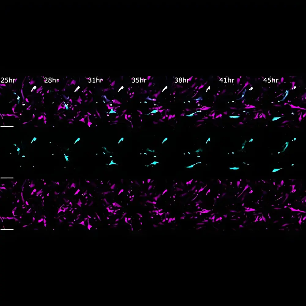 Leica THUNDER Imager 3D Live Cell Microscopy System