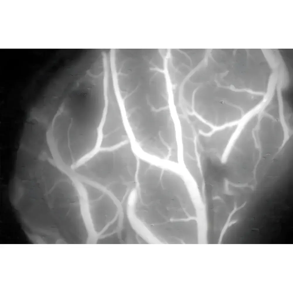 Leica FL800 Near-Infrared Fluorescence Module with 820 nm Excitation
