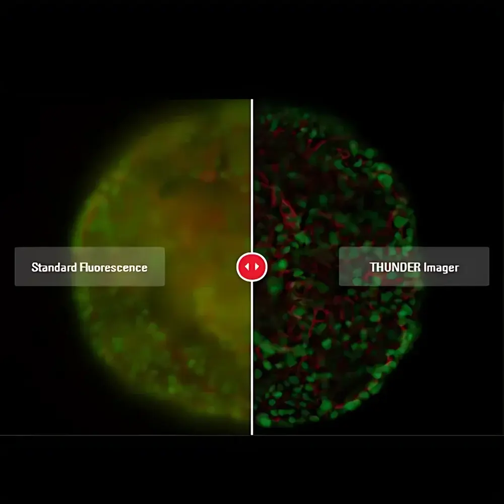 Leica THUNDER Imager Microscopic Image Analysis System