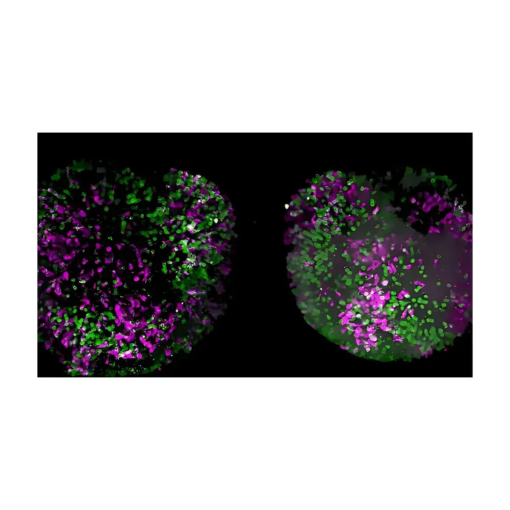 Leica Viventis Deep Dual-View Light Sheet Fluorescence Microscope