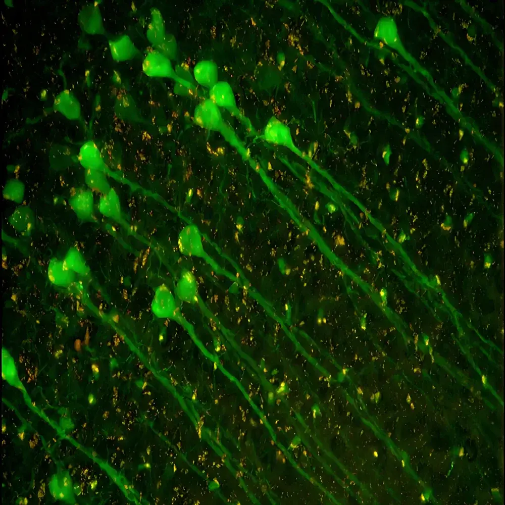 Leica THUNDER Imager Tissue Whole-Mount and Thick-Tissue Fluorescence Microscopy System