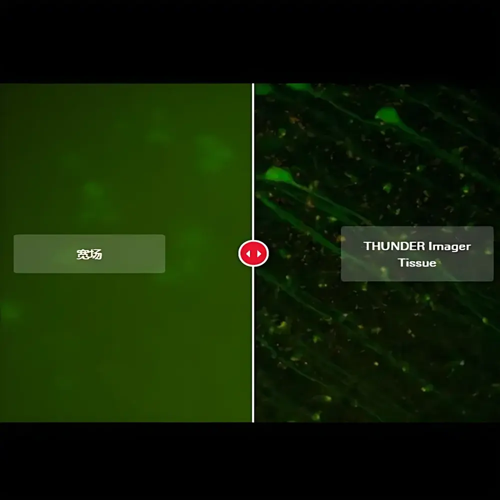 Leica THUNDER Imager Tissue Whole-Mount and Thick-Tissue Fluorescence Microscopy System