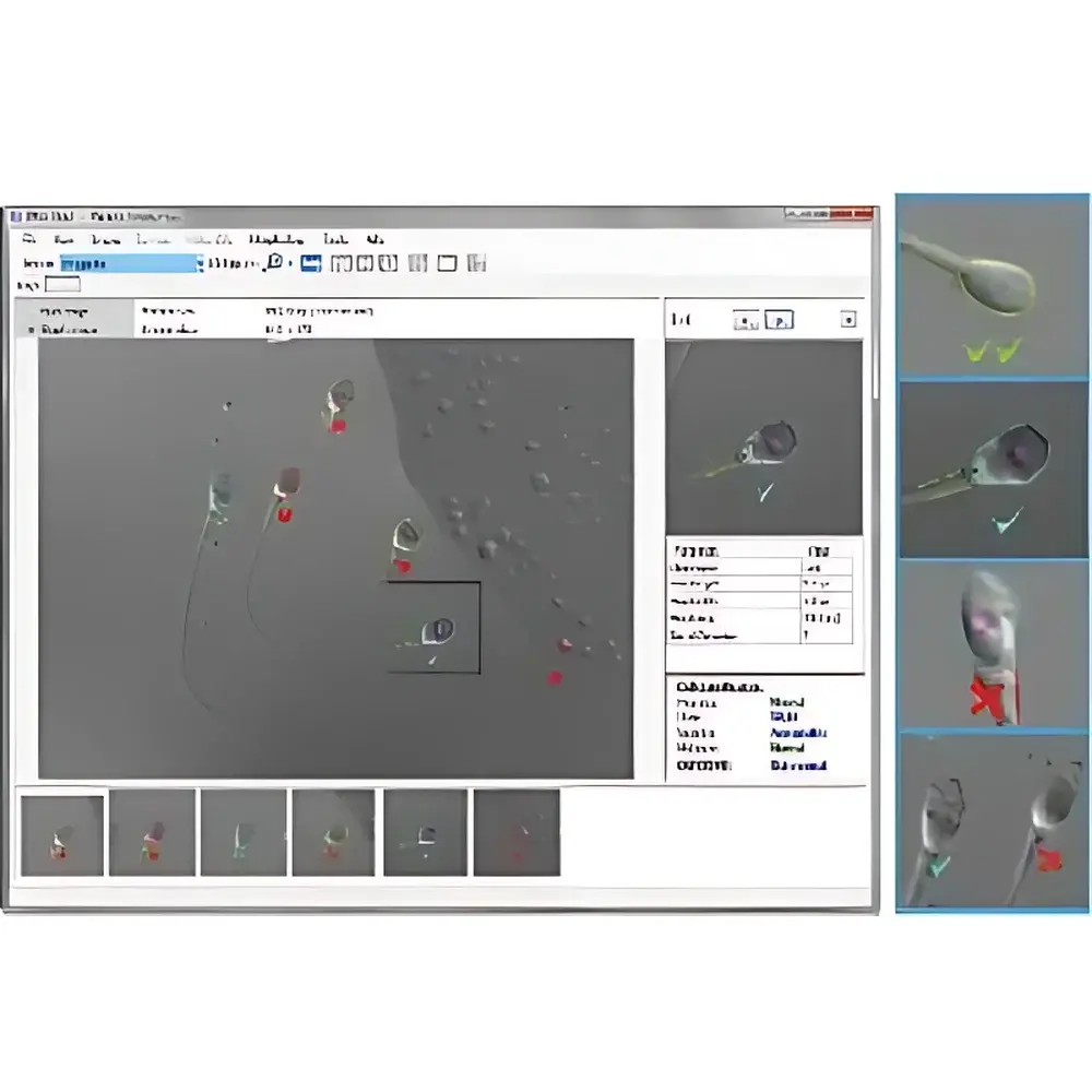 Hamilton Thorne IMSI Strict Automated Sperm Morphology Analysis Software