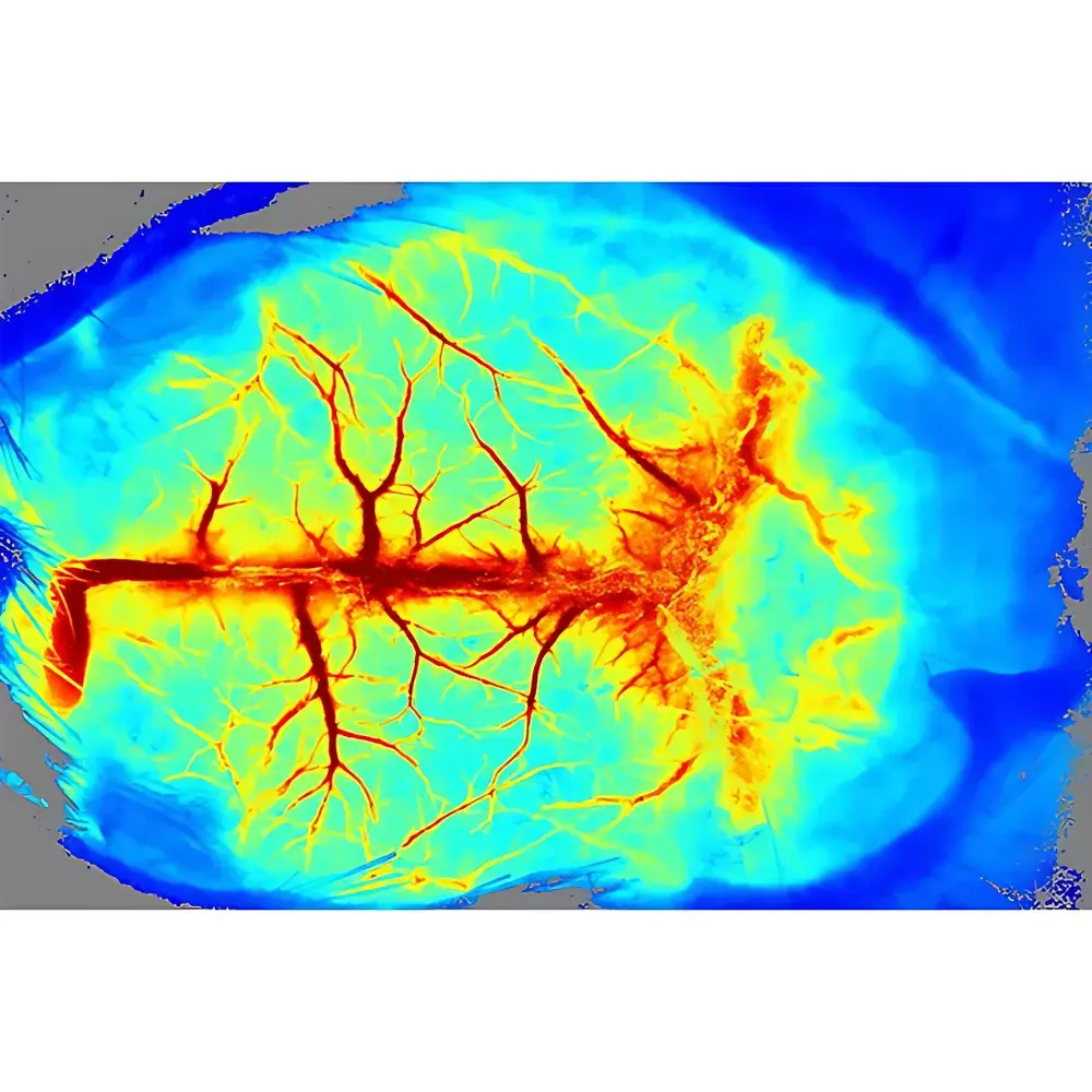 RWD RFSLI ZW Laser Speckle Contrast Imager