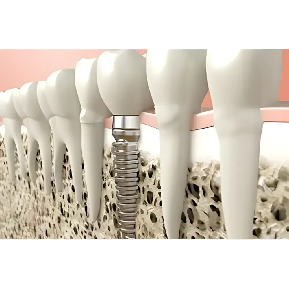 Attension Theta 3D Topography Module for Simultaneous Contact Angle and Surface Roughness Analysis