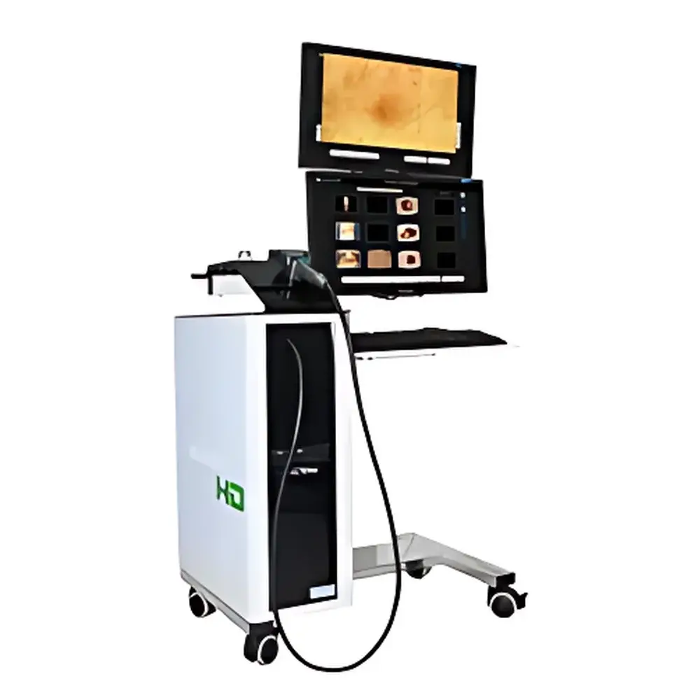 MoleMax HD Trichoscopy & Hair Growth Analysis System