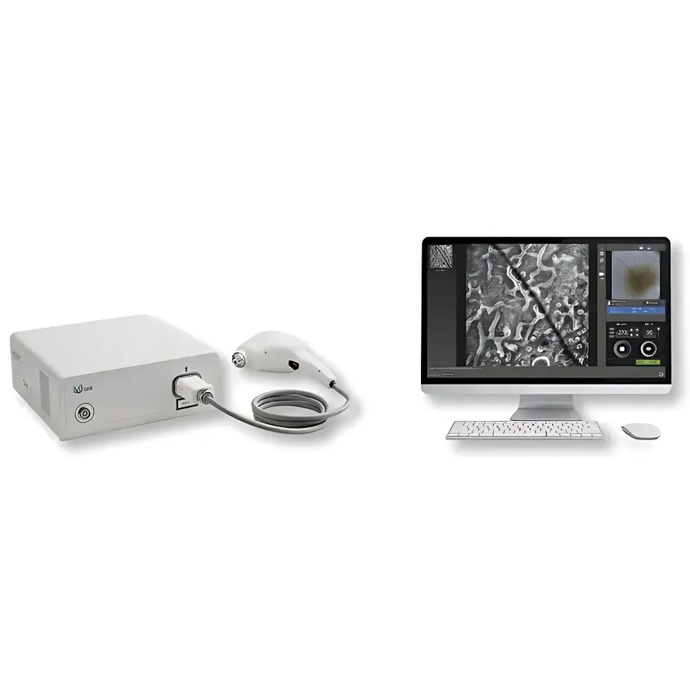 Transcend Vivoscope MY-600 Pro Reflectance Confocal Microscopy System