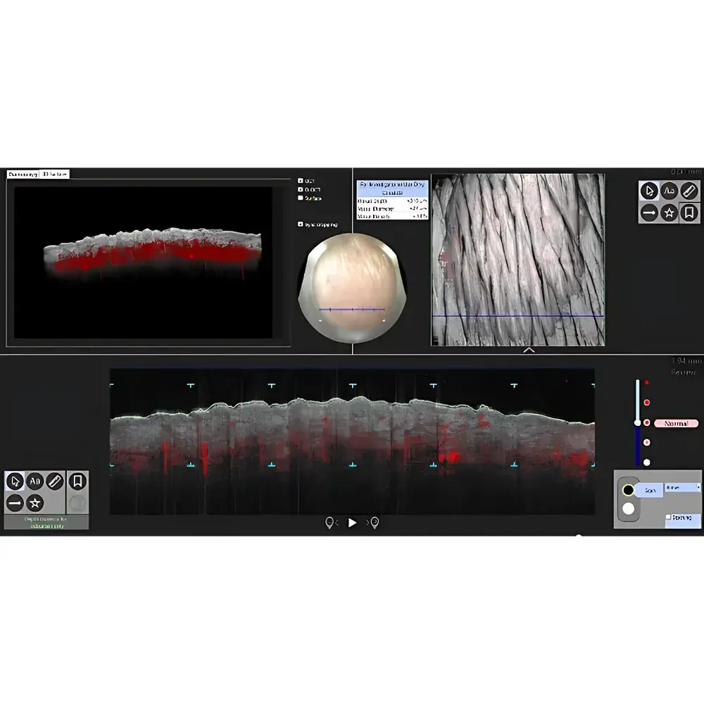 VivoSight AI Optical Coherence Tomography System