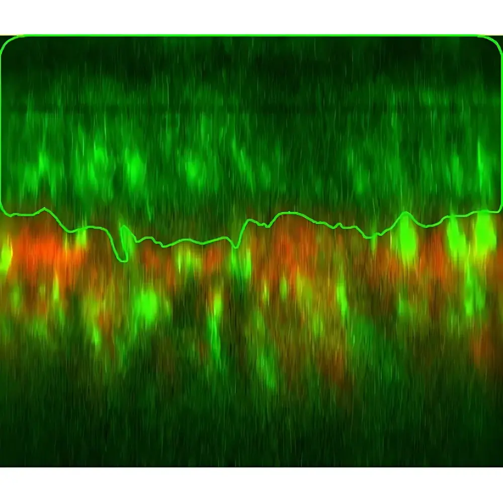 Transcend Vivoscope MY780 In Vivo Two-Photon Microscopy System