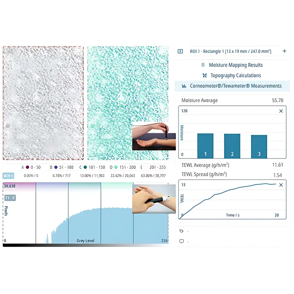 CK MoistureMap MM200 Skin Hydration Distribution Imaging System