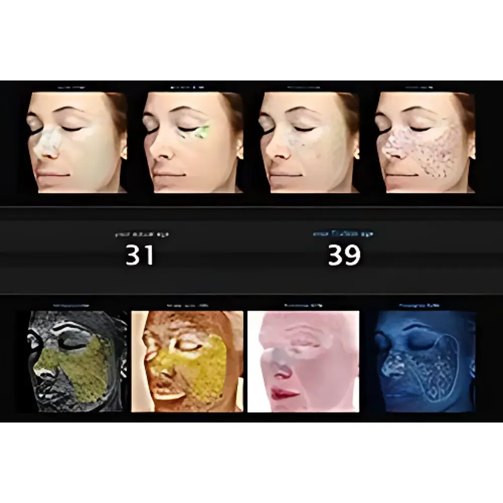 VISIA Skin Analysis System by Canfield