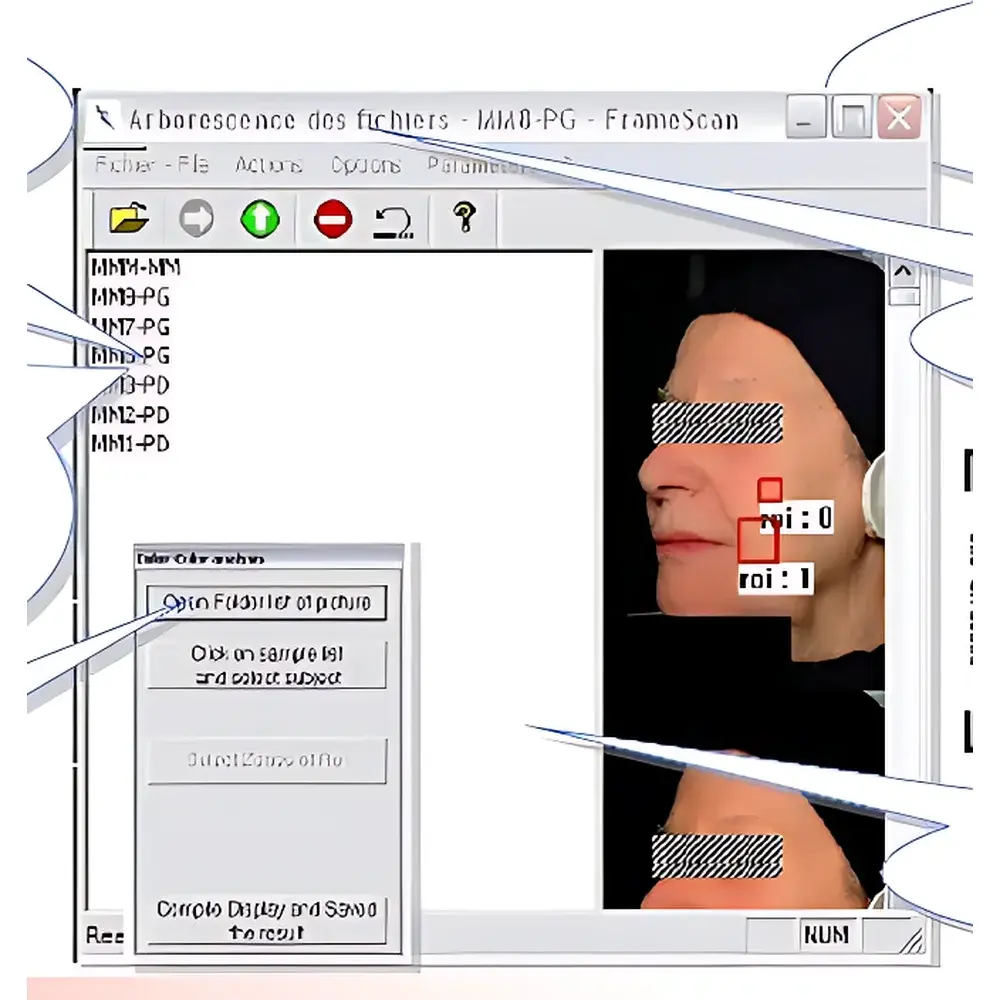 ORION FrameScan Skin Image Analysis Software