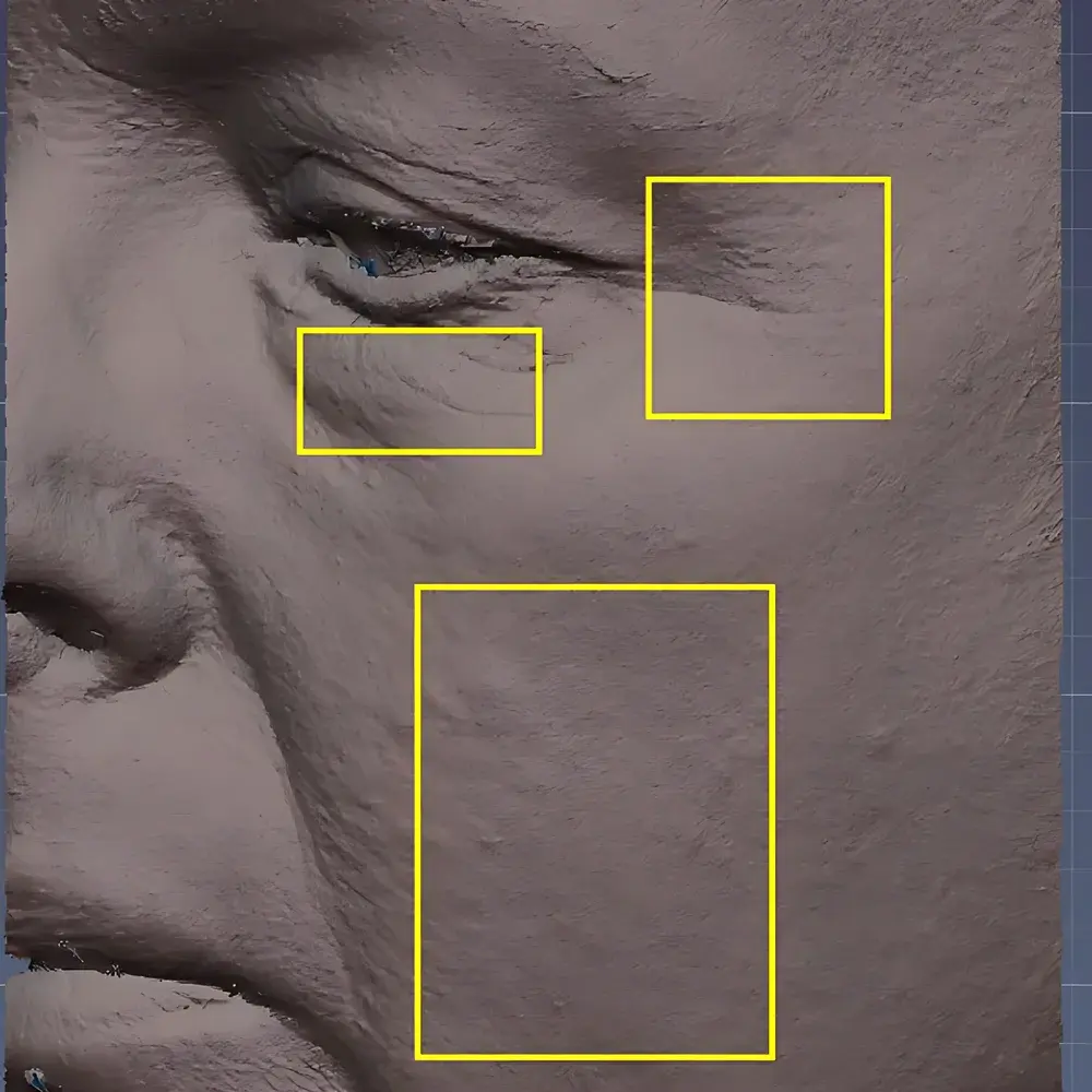 EOTECH EvaSKIN Skin Rapid Optical Imaging System