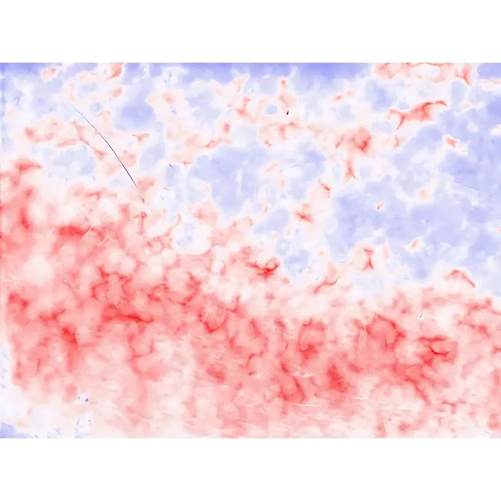 Pixience C-Cube Multifunctional Dermoscopic Imaging & Photometric Stereo Analysis System