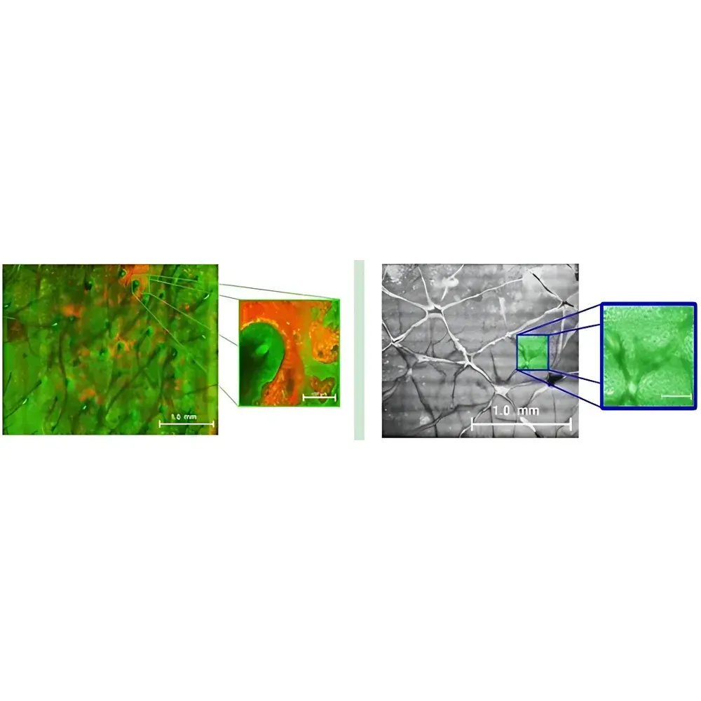 CK MPT flex Multiphoton Tomography System for Skin Imaging