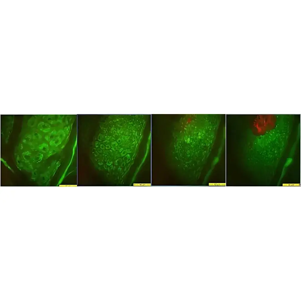 CK MPT flex Multiphoton Tomography System for Skin Imaging