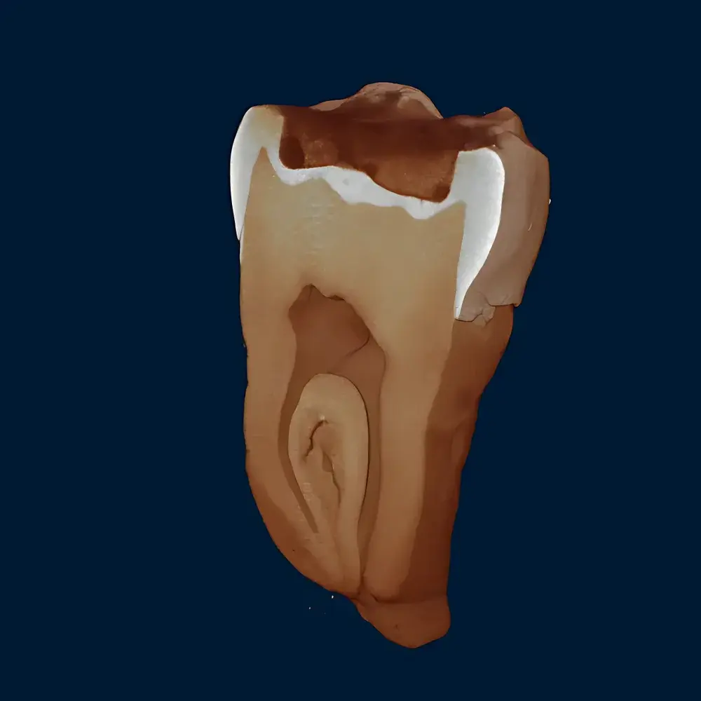 Neoscan N80 High-Resolution Benchtop Micro-CT System for Orthopedic Research