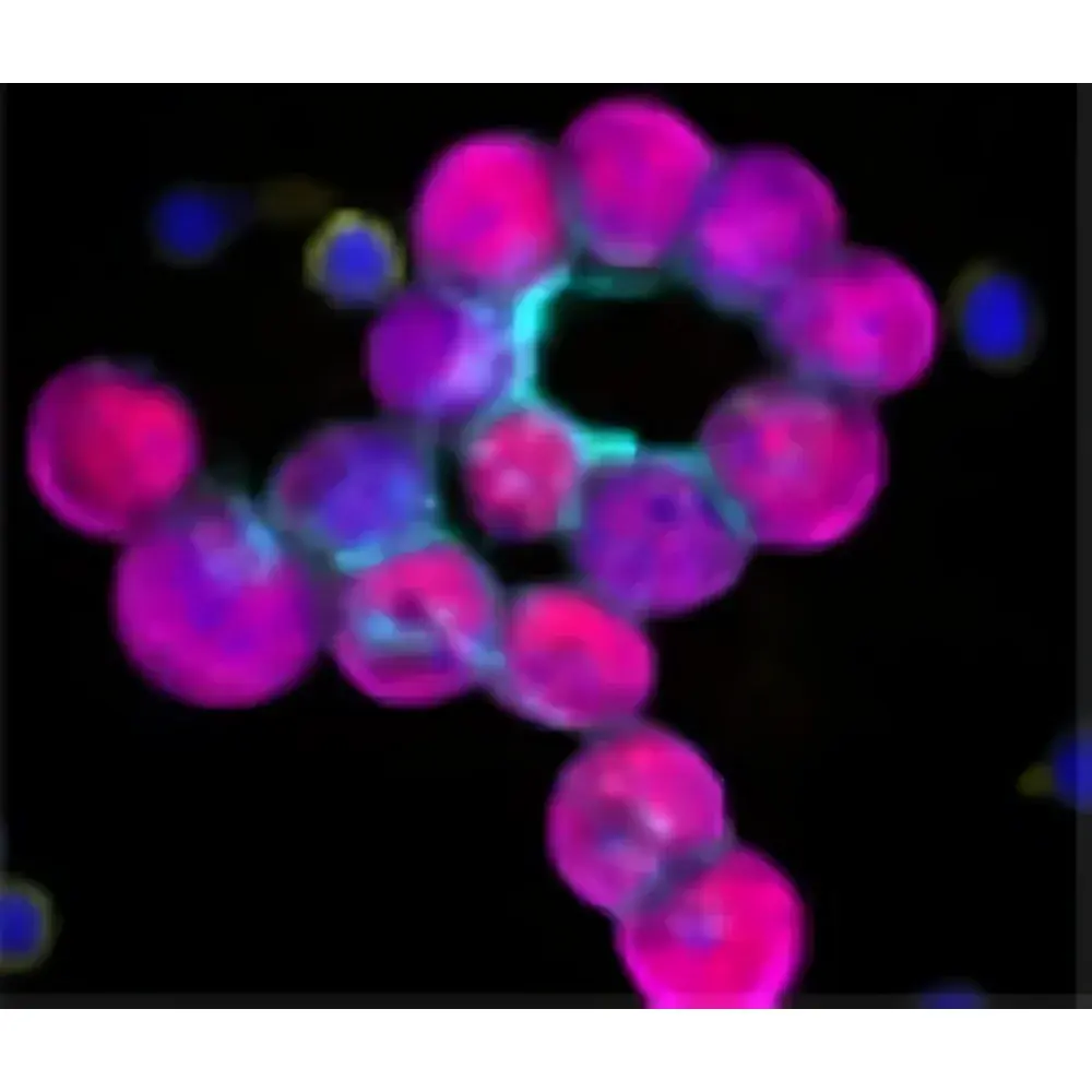 CyteFinder II Single-Cell Analysis Platform for CAR-T & Stem Cell Therapeutics