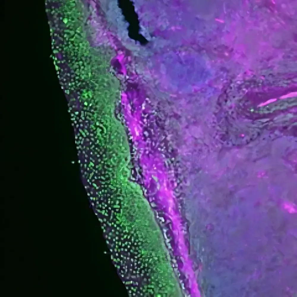 RareCyte CyteFinder II Quantitative Pathology Platform for Multiplex Tissue Imaging and Microdissection