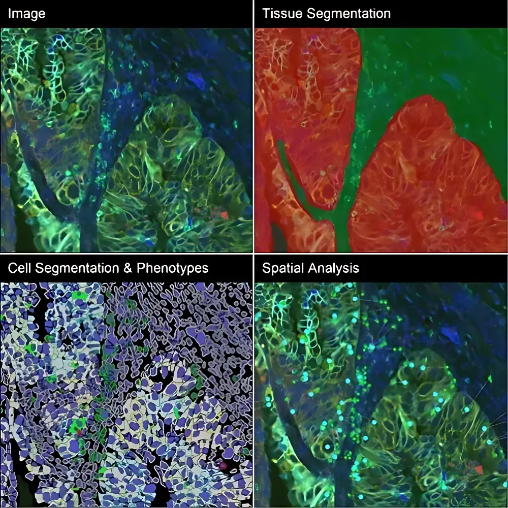 RareCyte CyteFinder II Quantitative Pathology Platform for Multiplex Tissue Imaging and Microdissection