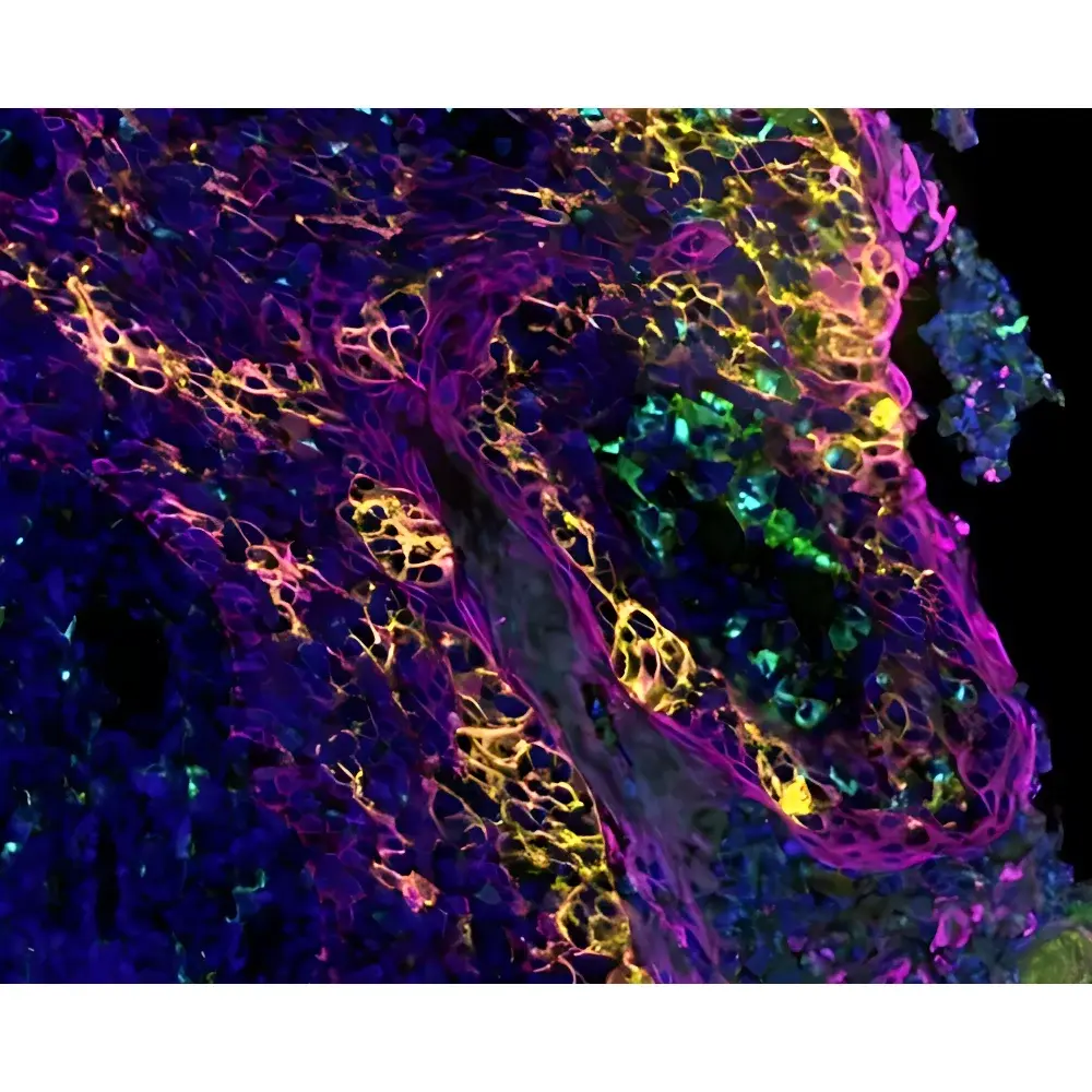 RareCyte CyteFinder II Quantitative Pathology Platform for Multiplex Tissue Imaging and Microdissection