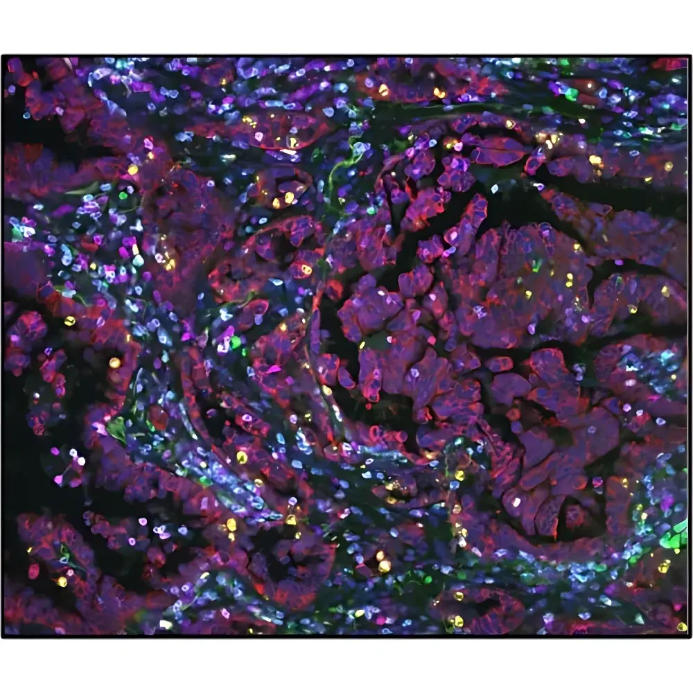 RareCyte CyteFinder II Quantitative Pathology Platform for Multiplex Tissue Imaging and Microdissection