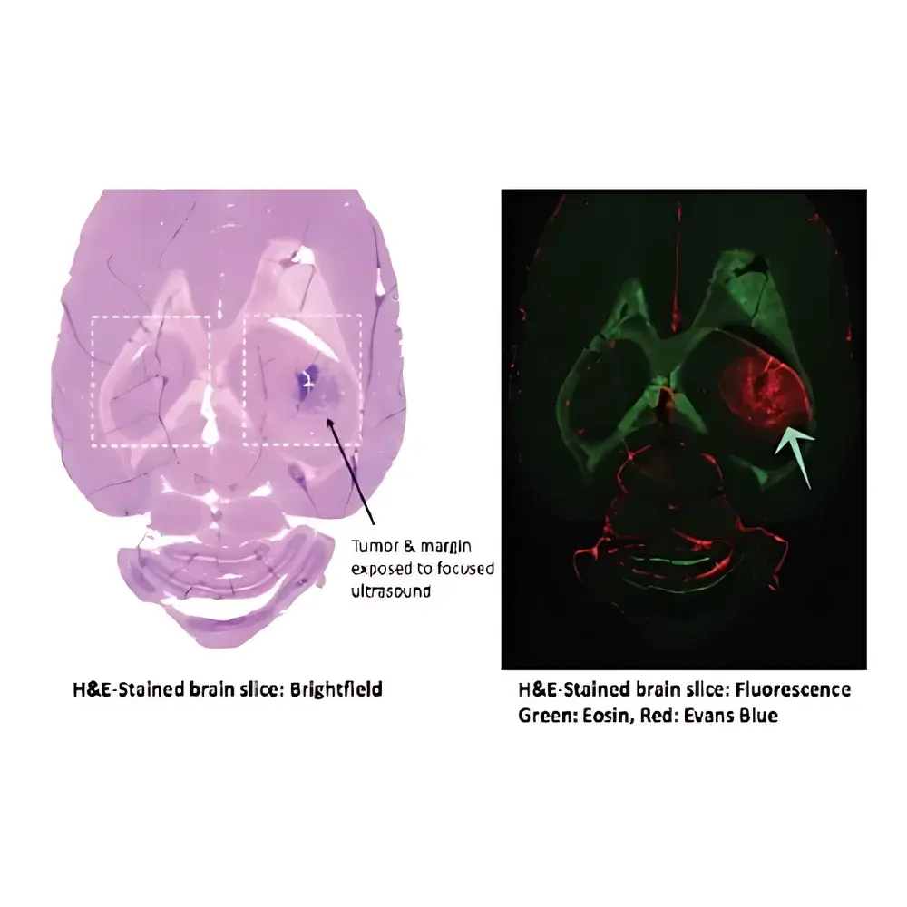 Pharmasonics PK-300/50 & LP-100 Focused Ultrasound (FUS) Blood-Brain Barrier Opening Systems
