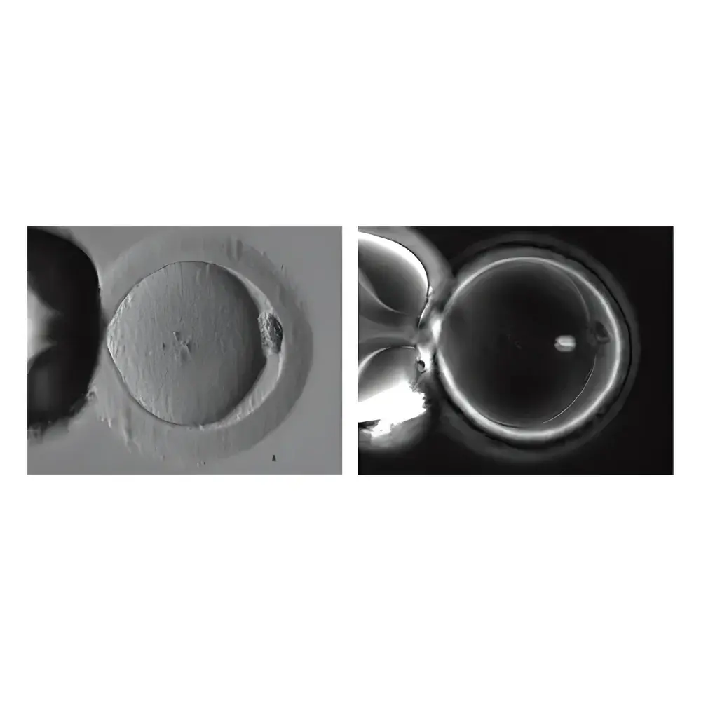Oosight Spindle Imaging System – LC-PolScope™-Based Polarized Light Microscopy Platform